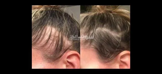 منتج للعناية بالشعر مكون من ٣ قطع - 8